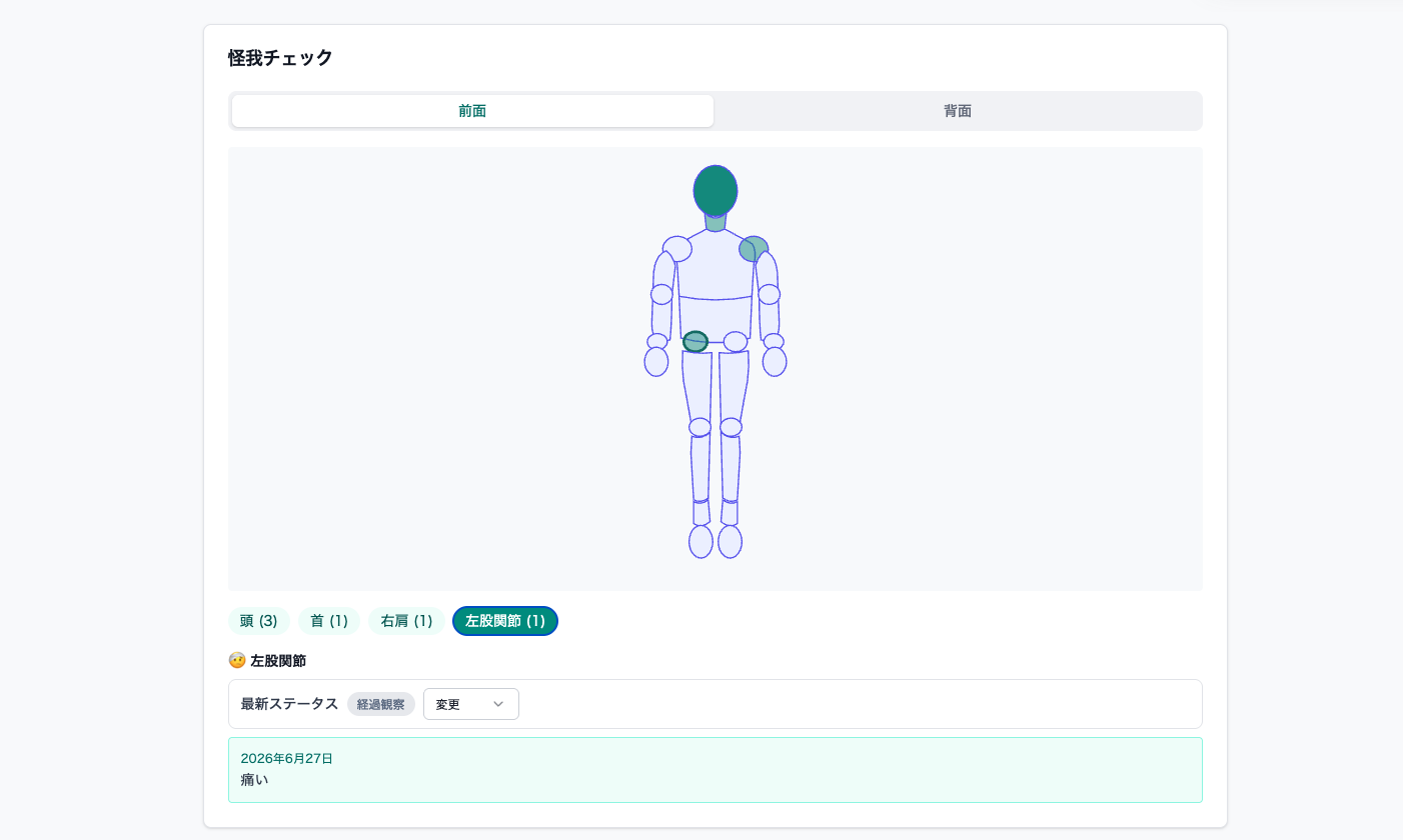 怪我チェックの管理画面。人体図で部位ごとの報告状況を確認できる